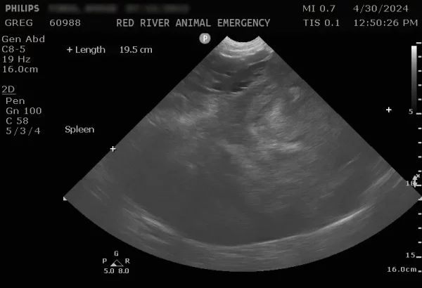 Abdominal ultrasound image showing a large splenic mass.